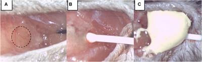 Hippocampal Atrophy Following Subarachnoid Hemorrhage Correlates with Disruption of Astrocyte Morphology and Capillary Coverage by AQP4